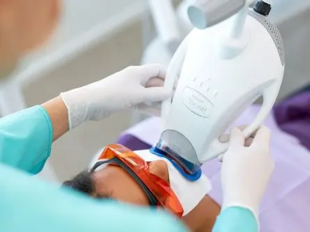 Sbiancamento dentale nello studio dentistico a Caslano